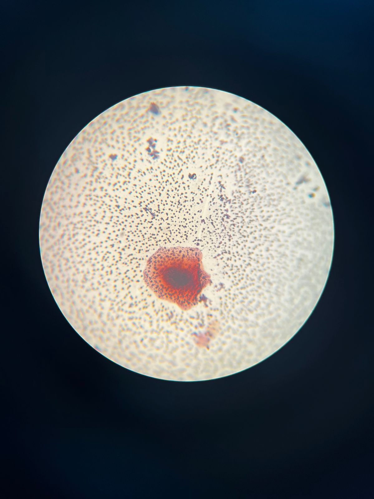 Micrografía de la flora bacteriana del sarro dental teñida con Gram.