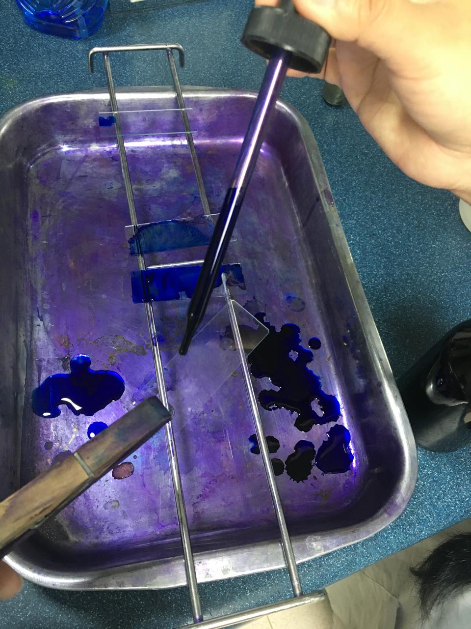 Figura 10: Aplicación de colorante azul de metileno.