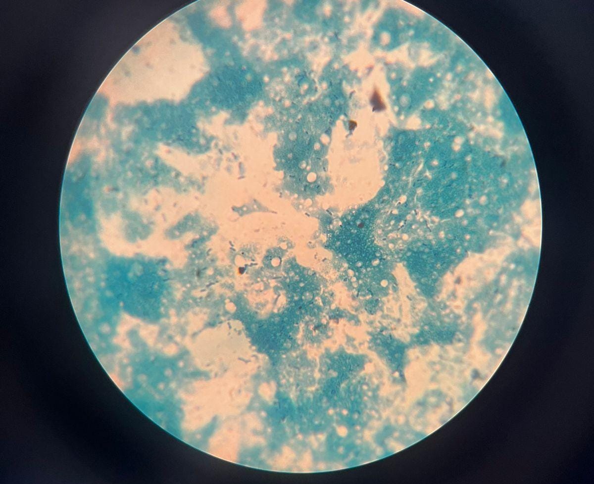 Micrografía de bacterias de yogur teñidas con azul de metileno.