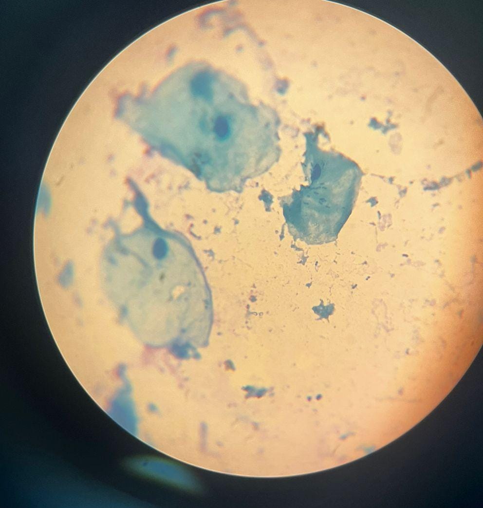 Micrografía de células epiteliales y bacterias de sarro dental teñidas con azul de metileno.