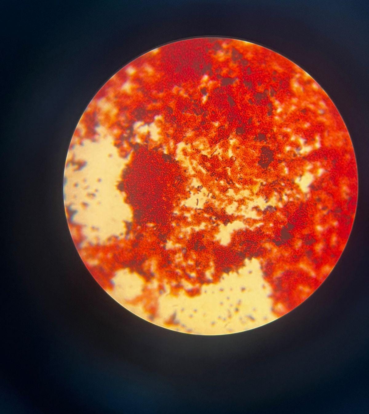 Micrografía de la flora bacteriana del yogur teñida con Gram (mayormente bacilos).