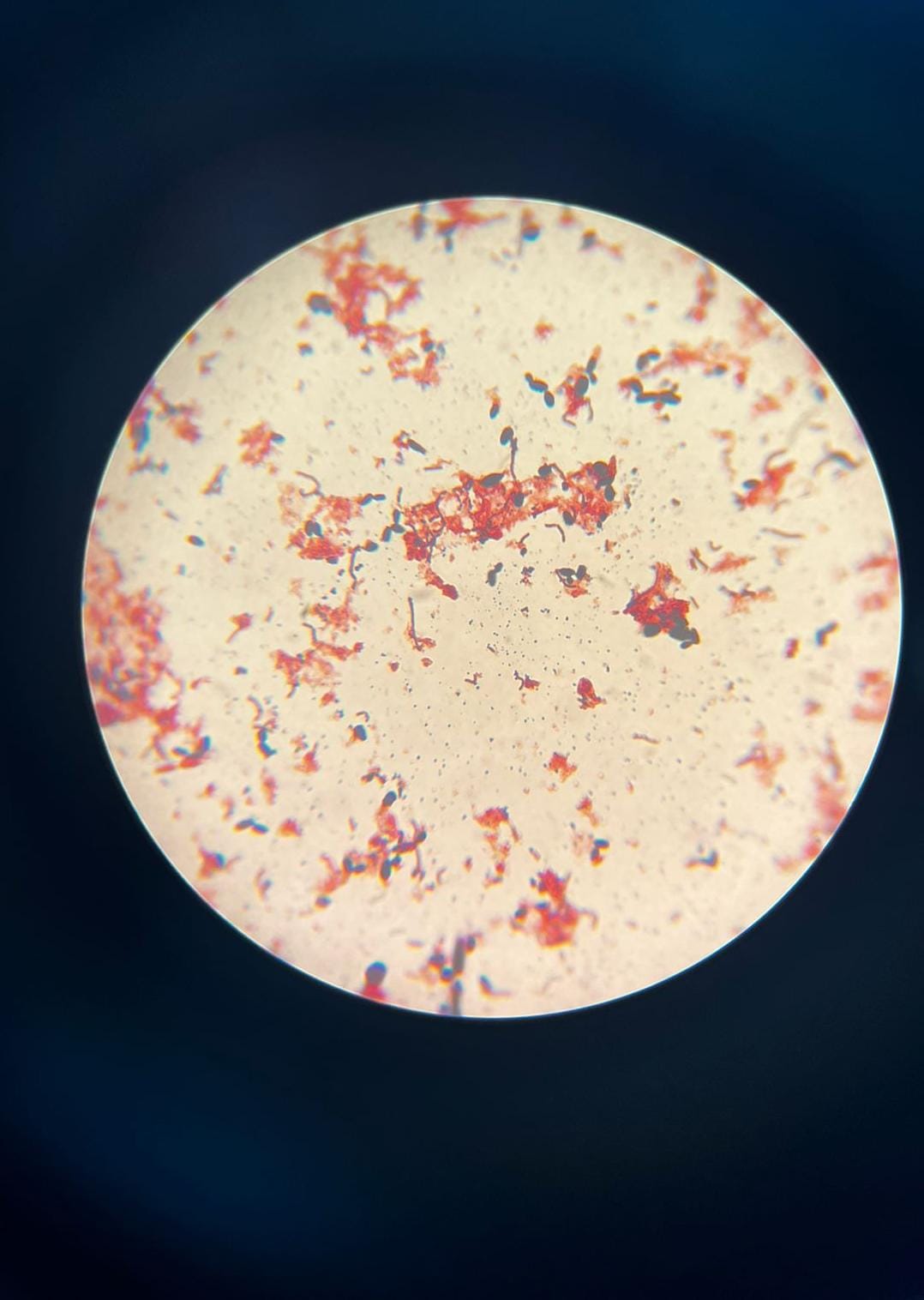 Micrografía de bacterias y levaduras de uva fermentada teñidas con Gram.
