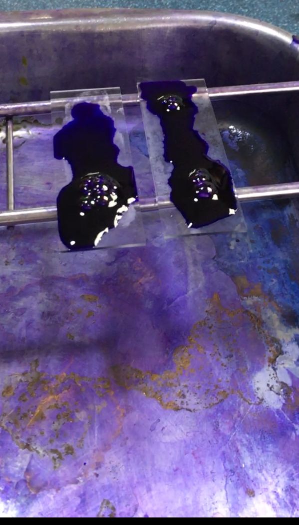 Figura 4: Aplicación de colorante azul de metileno.